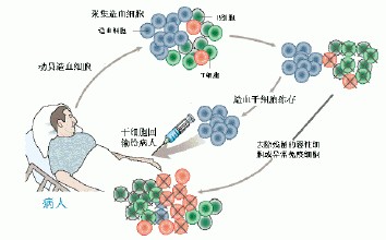 造血干细胞移植的常识