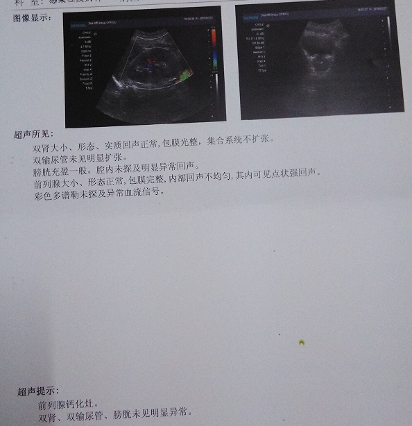 小時(shí)候開(kāi)始手淫，有十年的手淫史，因?yàn)槊髂晡逡灰獪?zhǔn)備結(jié)婚，所以