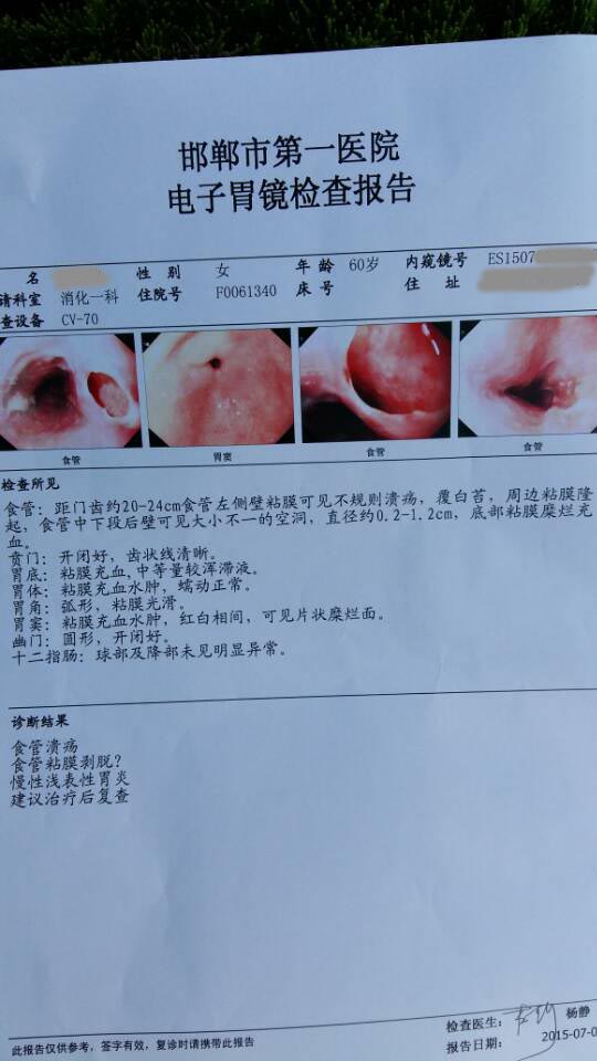 吃东西后胃涨呕吐后呕吐不止后来呕吐物里带血上医院做胃