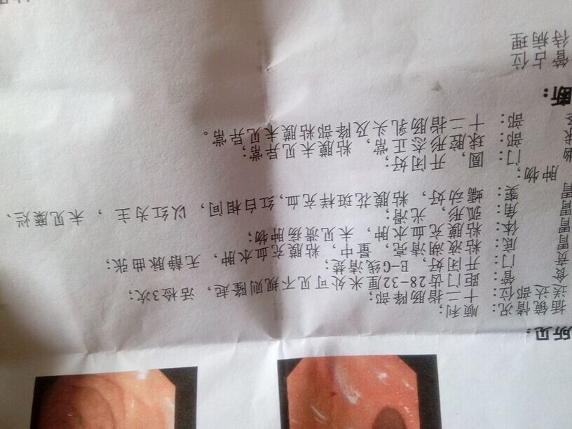 你好胃镜检查距门齿28-32cm处可见不规则隆起粘膜充血水肿