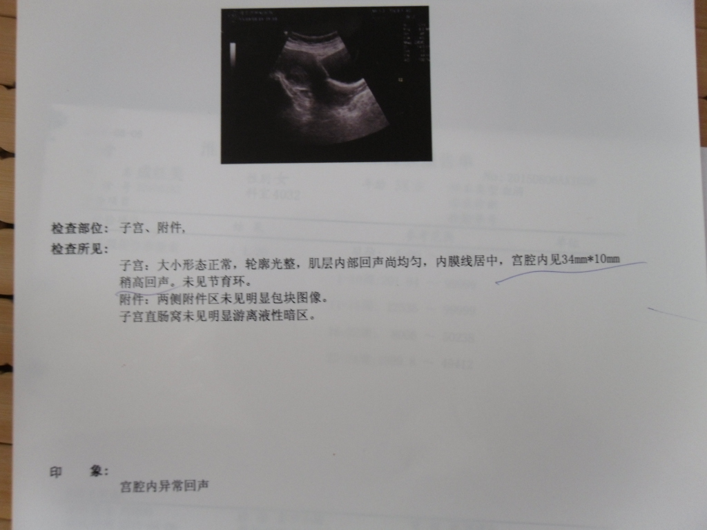 B超单:宫腔内可见妊娠囊回声,大小约45*31mm