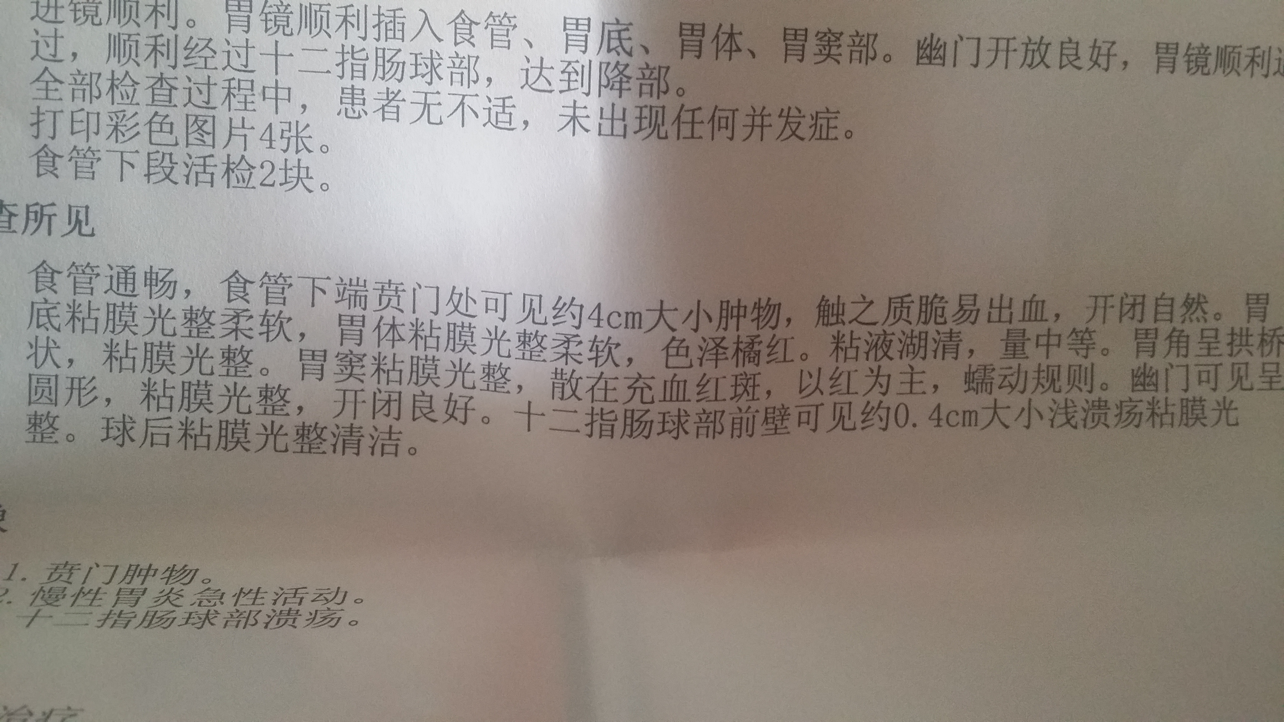 腹脹反酸灼熱大便不暢