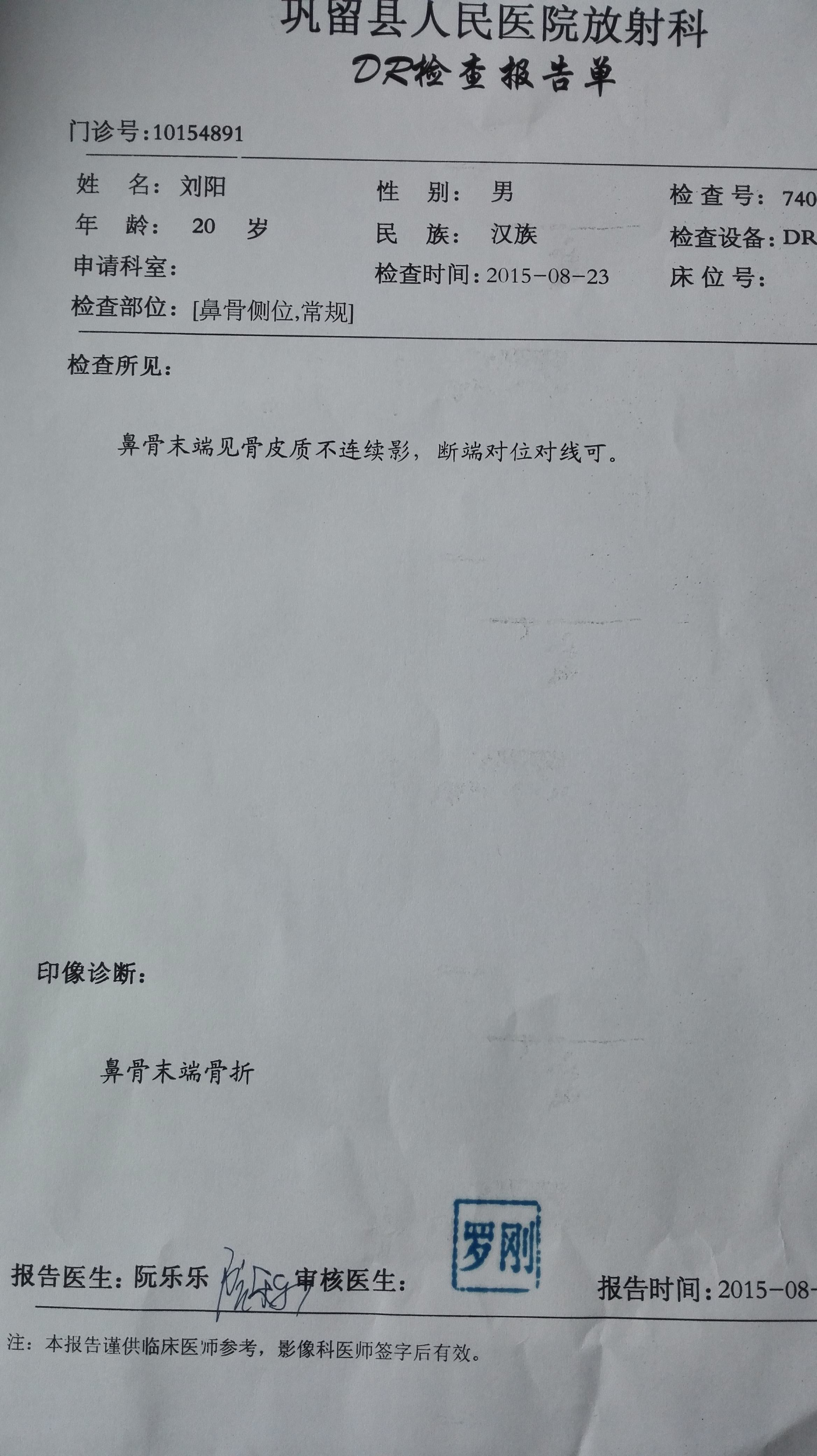 鼻子受到外部撞擊檢查說骨折請問醫(yī)生從片上看我應(yīng)該如何治療。醫(yī)