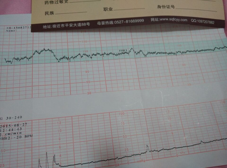 您好、孕九個(gè)月、醫(yī)生病例上寫(xiě)胎動(dòng)異常什么的、后面的我看不懂、