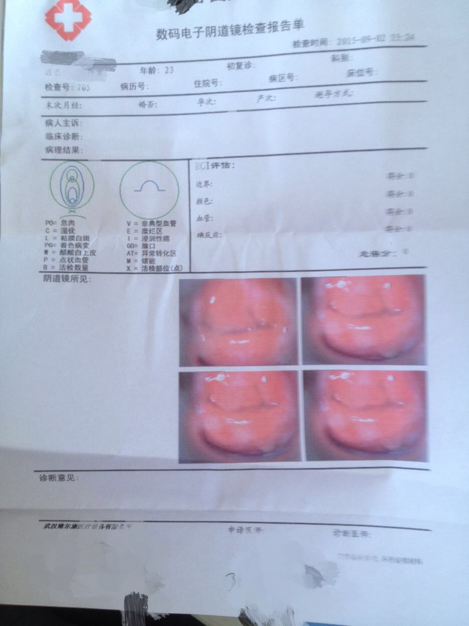 三年前分泌物開始不正常去年濱醫(yī)檢查宮糜二度有陰道炎醫(yī)生給開了