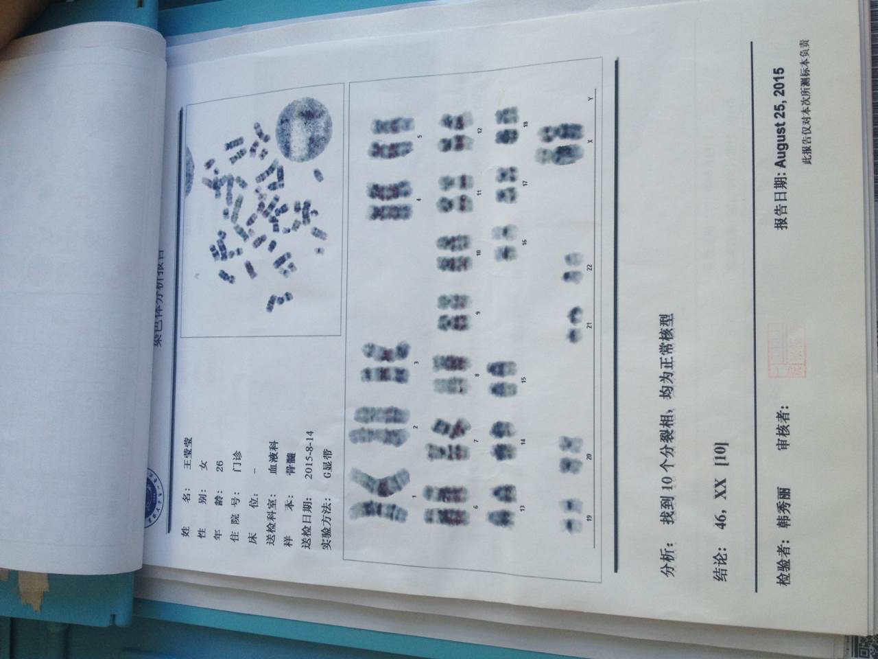 MDS的RCMD?？梢灾委焼?，還有多長(zhǎng)的生存期。