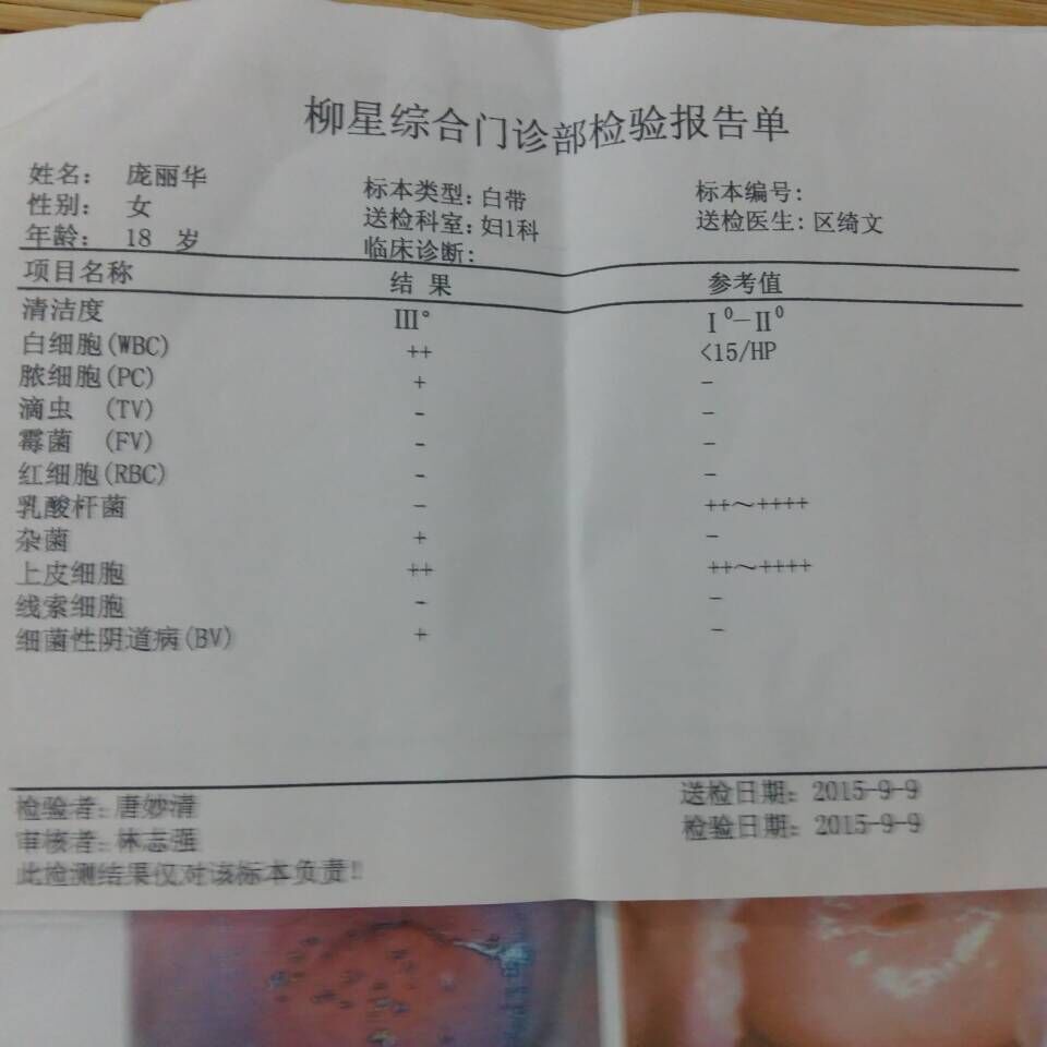 我20歲，去醫(yī)院檢查婦科，得出結(jié)論陰道炎，宮頸柱狀上皮外移，