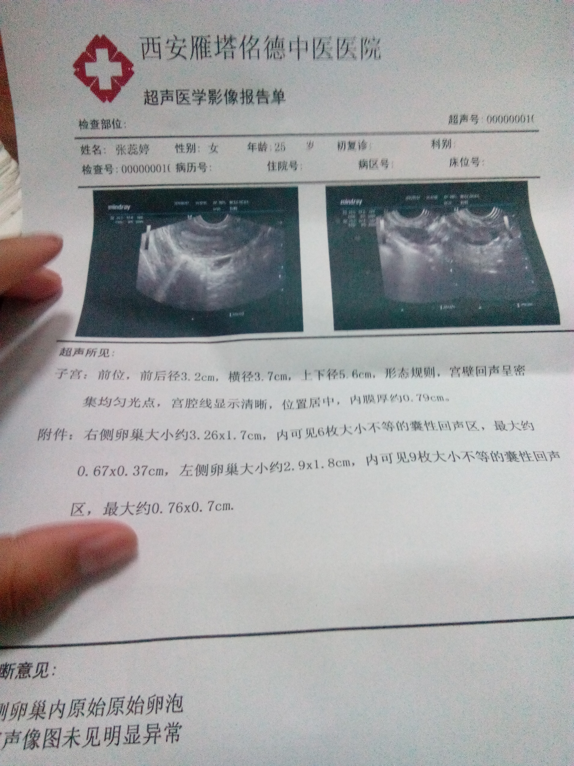 麻煩問(wèn)下醫(yī)生我這個(gè)算是多囊綜合癥嗎？急