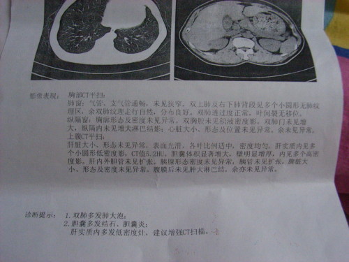 做檢查的結(jié)果，能解釋一下我這個病是怎么一回事嗎？