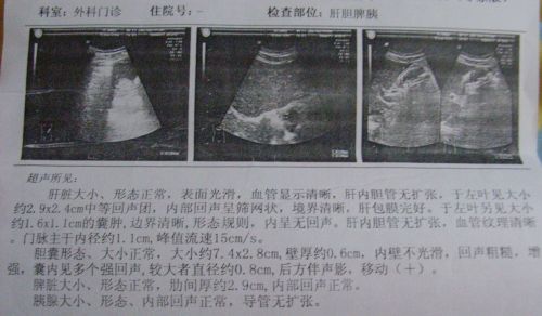 做檢查的結(jié)果，能解釋一下我這個病是怎么一回事嗎？