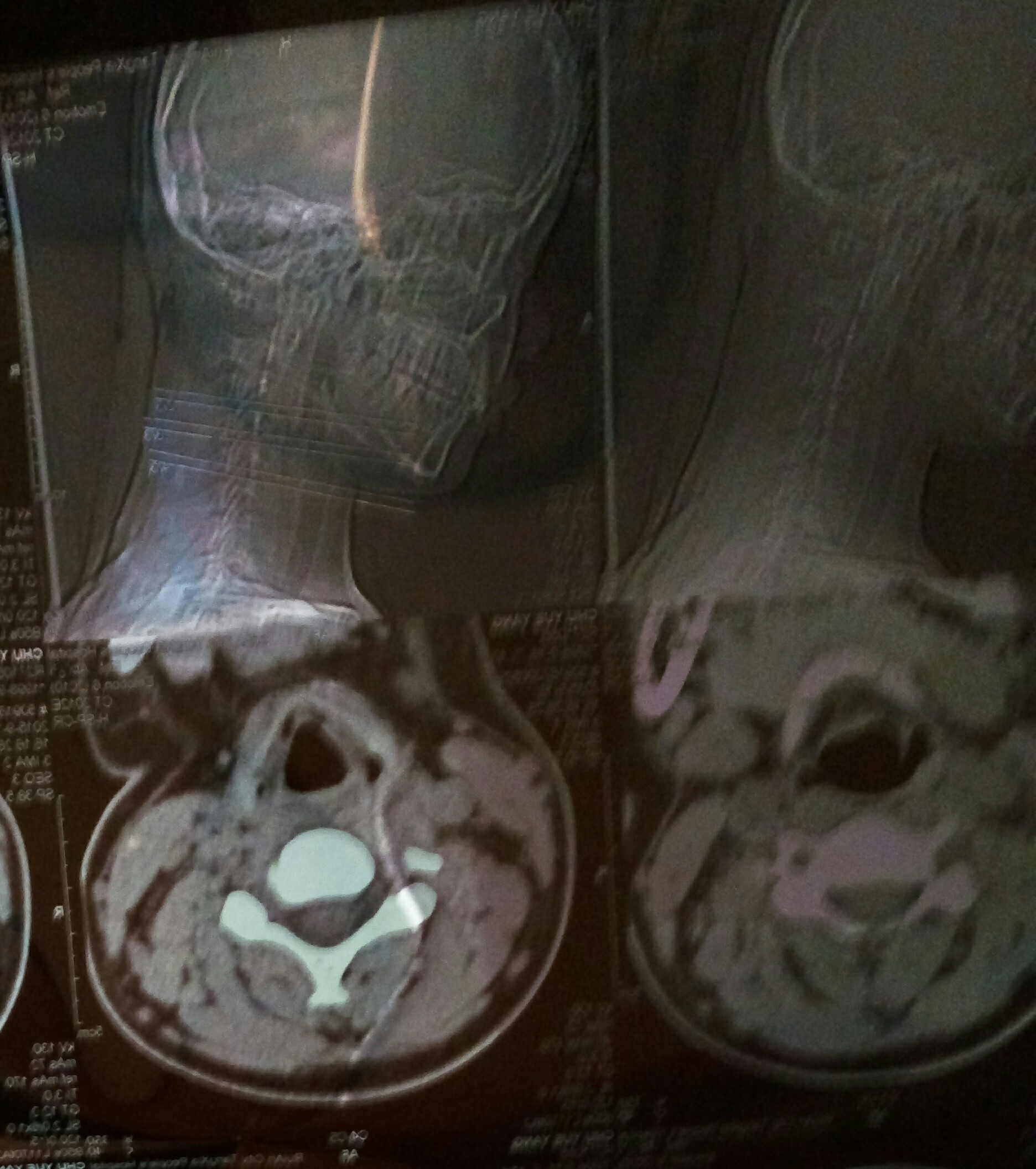 脖子抬頭就疼，疼了有兩個(gè)星期了，用吹風(fēng)機(jī)吹會(huì)好一會(huì)，但是過(guò)會(huì)