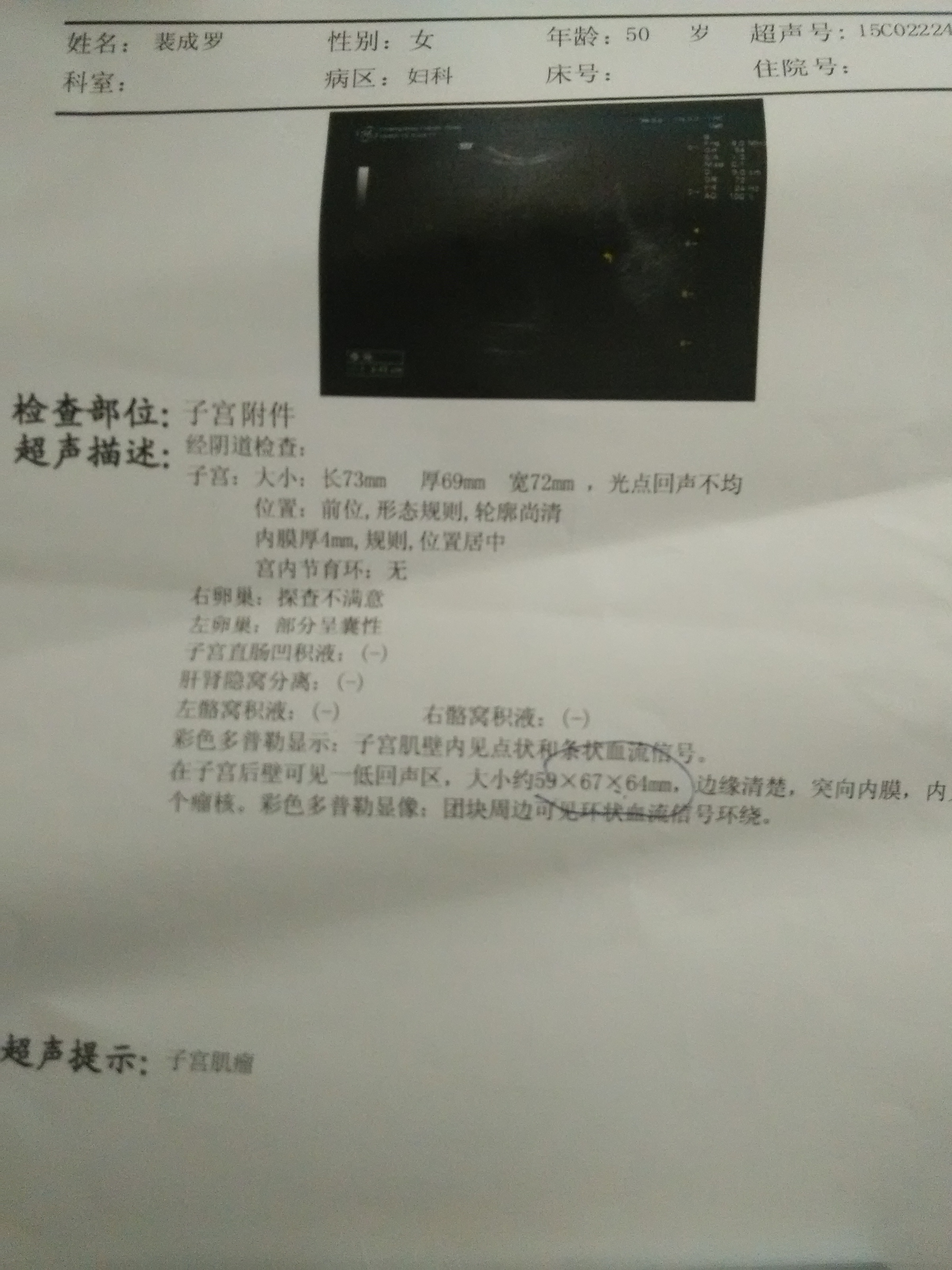 今年50歲了，今天查出子宮肌瘤6公分了，一定要開刀治療嗎