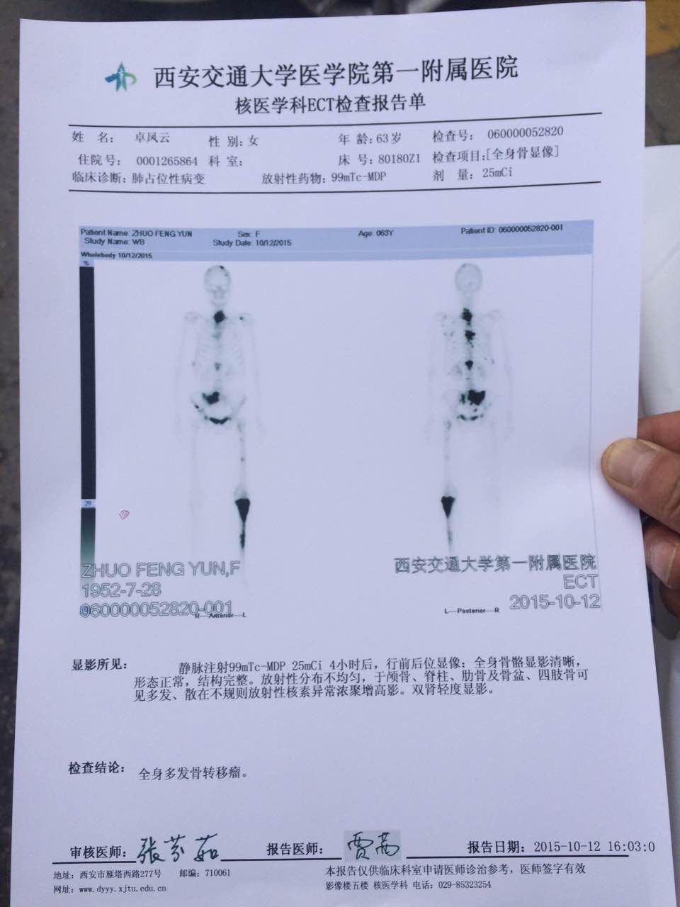 現(xiàn)在發(fā)燒38、5度左右，后背和腿部疼痛，在醫(yī)院還末用藥，像這