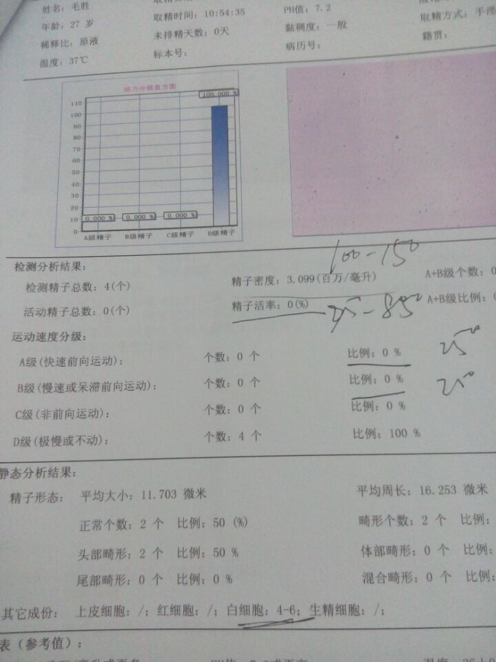 精子存活低看病后吃了一個月的頭孢拉定消炎藥衣原體陰性