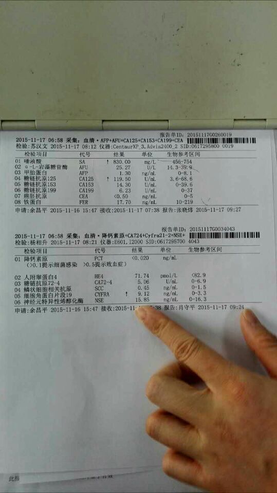 唾液酸830糖鏈抗原125119,細胞角蛋白19片段9.12