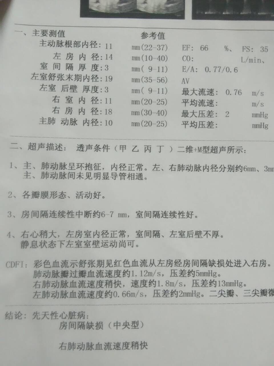 你好能不能幫我看看小孩具體得了什么癥狀？