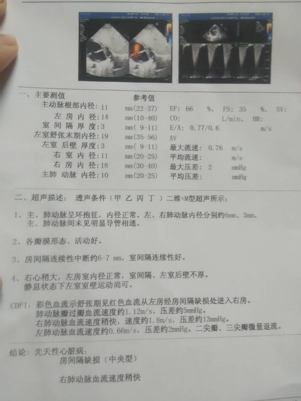 你好能不能幫我看看小孩具體得了什么癥狀？