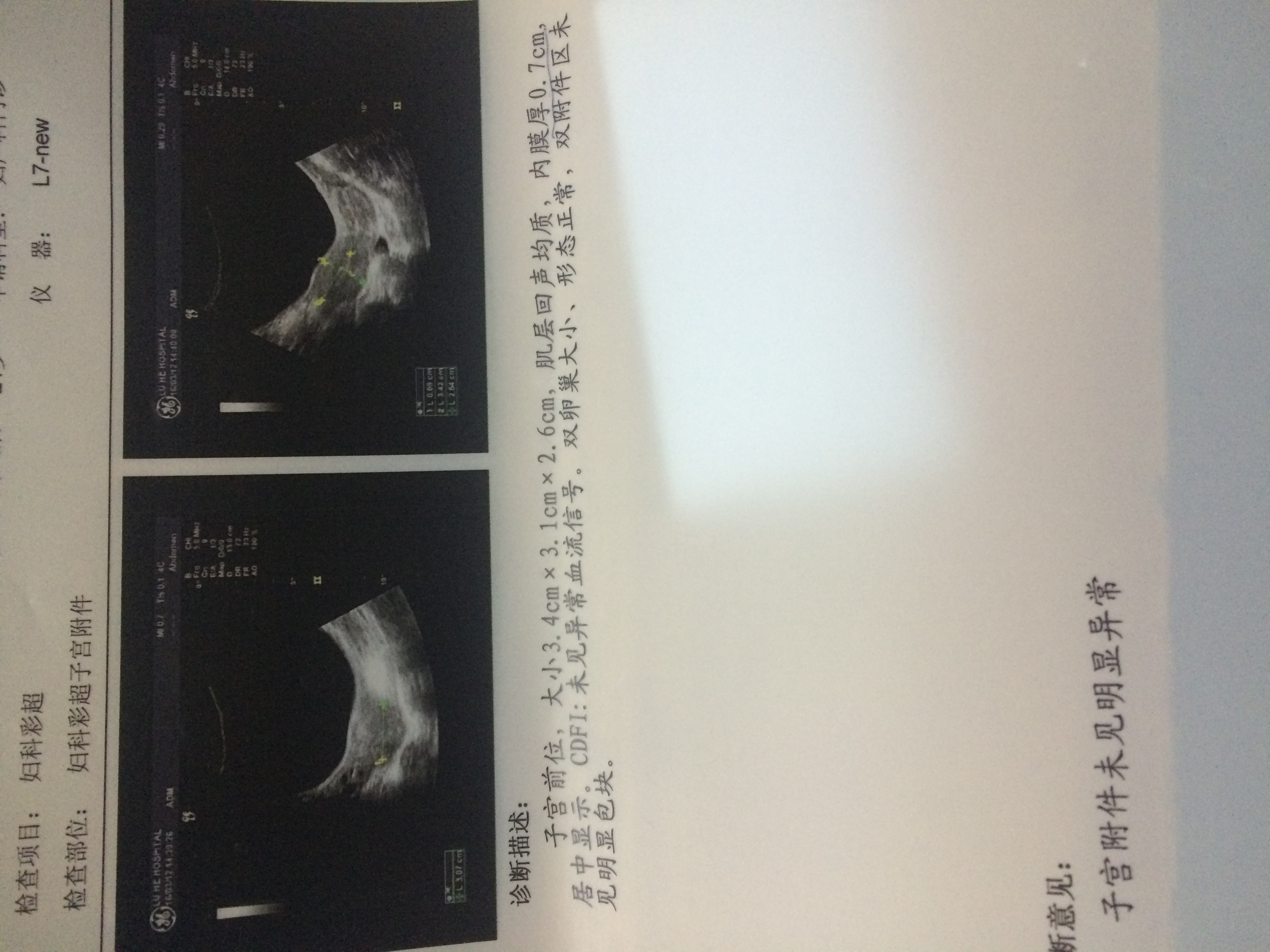 四個月沒來月經(jīng)B超檢查正常