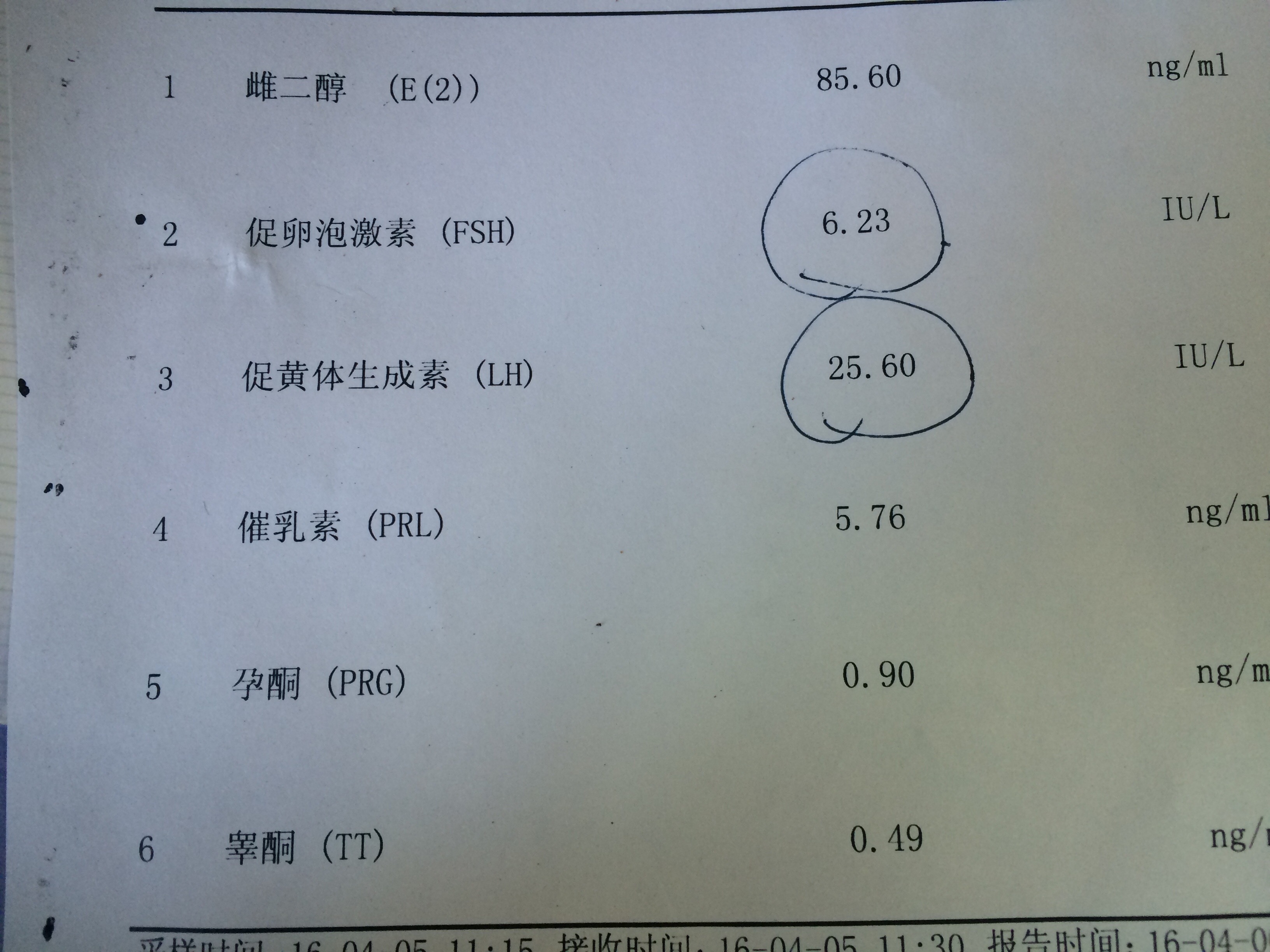 四個月沒來月經(jīng)B超檢查正常