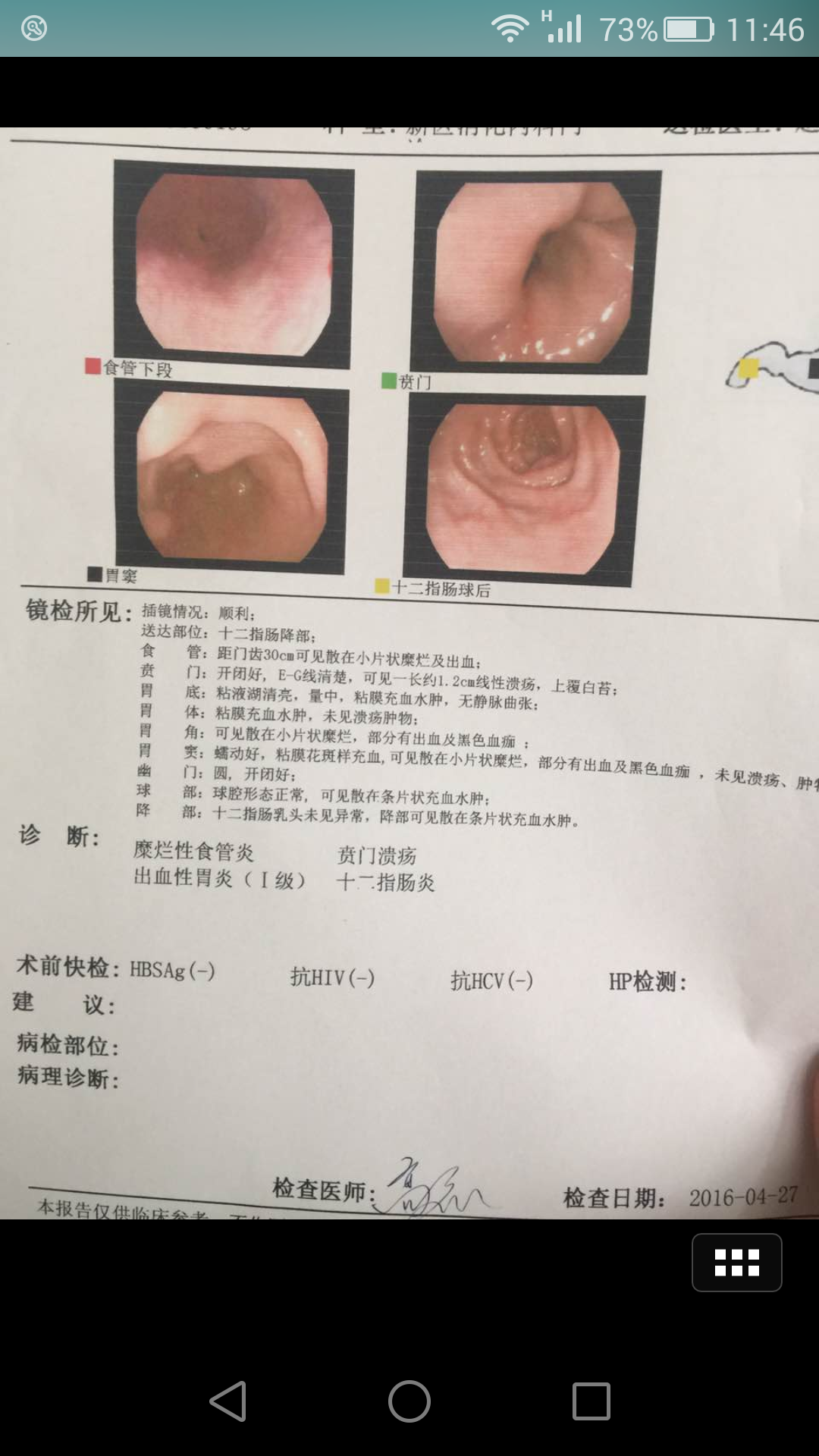 我爸爸今天去醫(yī)院做了檢查，這是檢查結(jié)果你幫我看看，這嚴(yán)重嗎