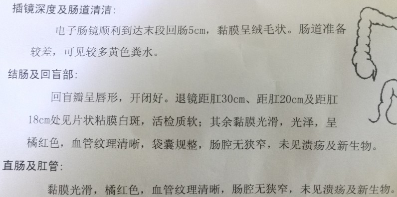 半年前左下腹部幾個(gè)點(diǎn)疼，去醫(yī)院做的檢查。