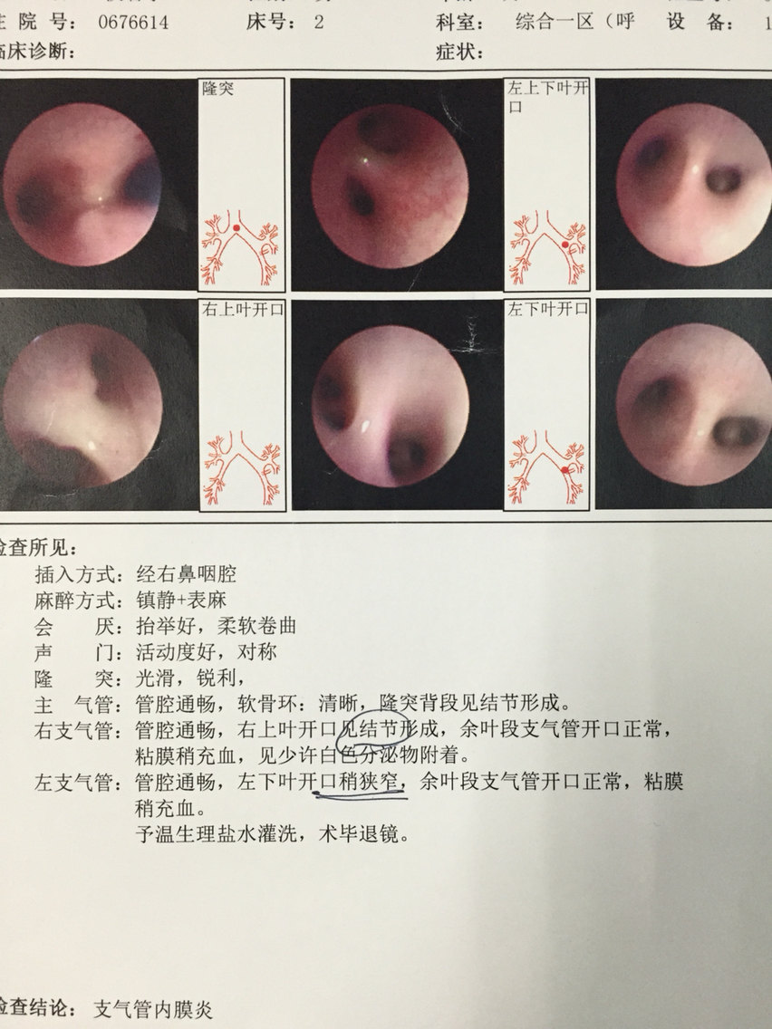 小孩現(xiàn)在15個(gè)月，6個(gè)月的時(shí)候有類百日咳，持續(xù)了6個(gè)月治好，