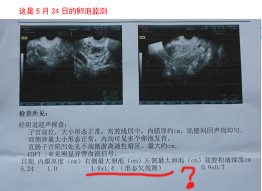 我39歲了，想要2胎，要了3個(gè)月了沒(méi)要上，之前政策沒(méi)放開(kāi)時(shí)，