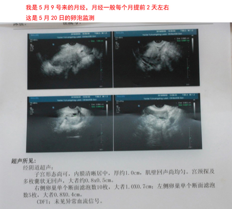 我39歲了，想要2胎，要了3個(gè)月了沒(méi)要上，之前政策沒(méi)放開(kāi)時(shí)，