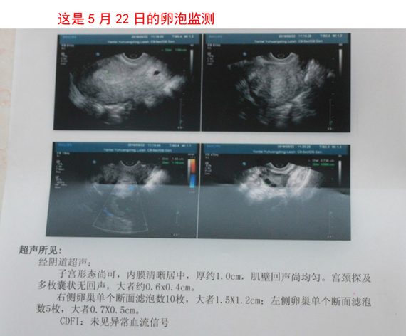 我39歲了，想要2胎，要了3個(gè)月了沒(méi)要上，之前政策沒(méi)放開(kāi)時(shí)，