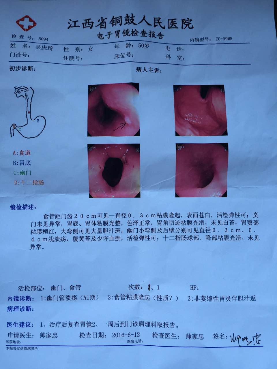 肚子疼，想嘔吐，喉嚨有異物感和灼燒感。就一直吐不出來