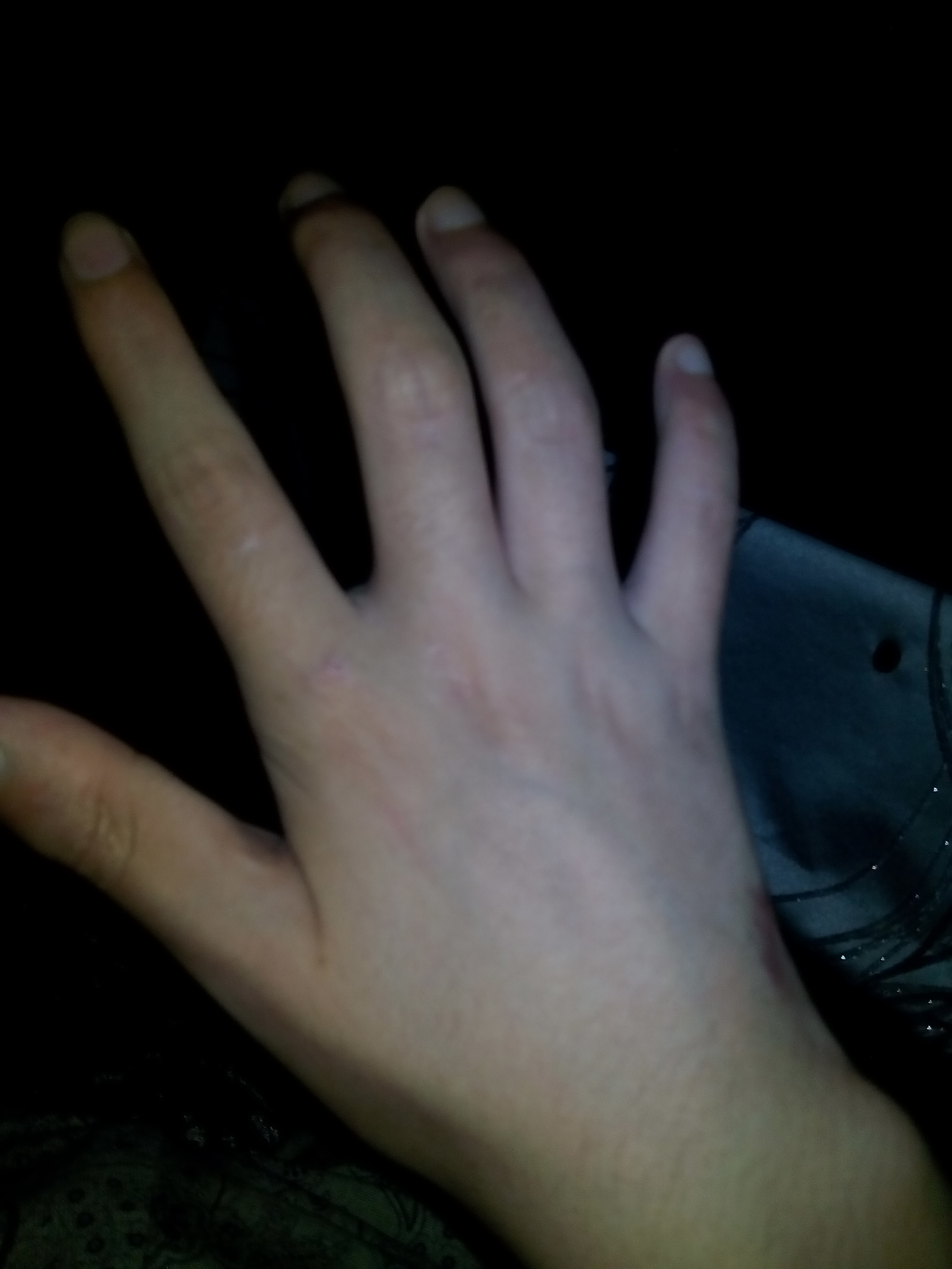 右手无名指中指小指的一半没有知觉,这是不是神经损伤