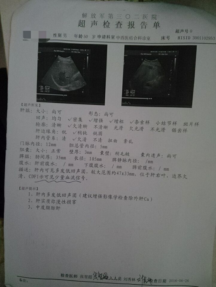 男，50歲，有長期飲酒習(xí)慣，有三年多肝炎病史小三陽，一直吃藥