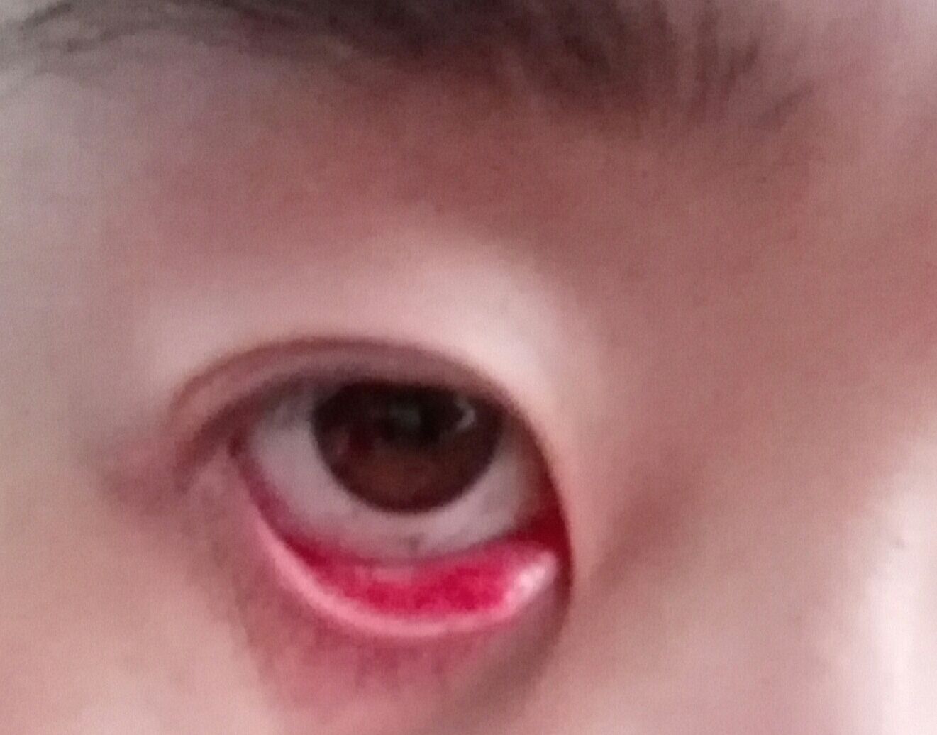 眼角红肿疼是怎么回事,内眼角红肿 - 伤感说说吧