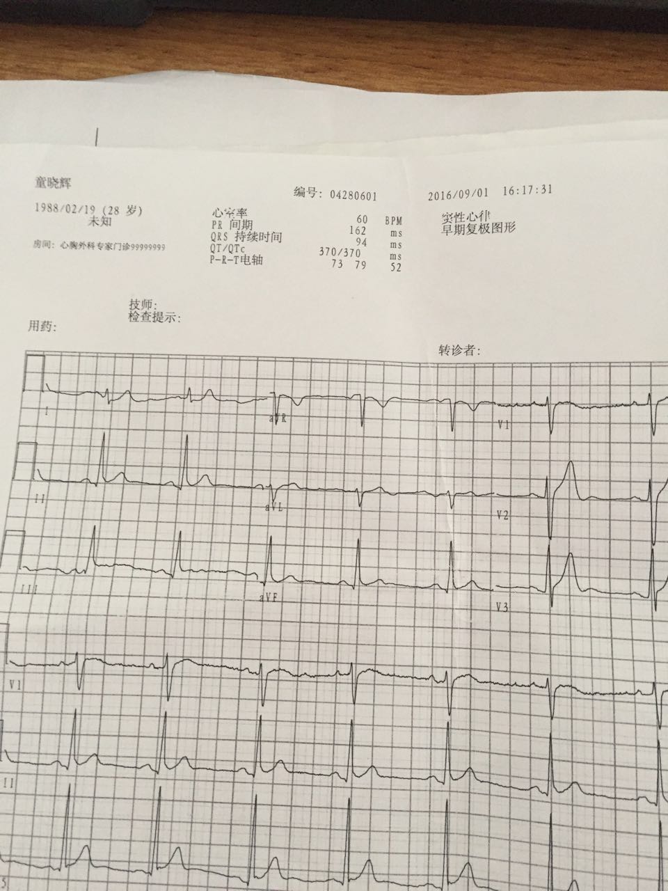 9月2号因为胸痛做了ct和心电图彩超等，看到ct报告说3毫米