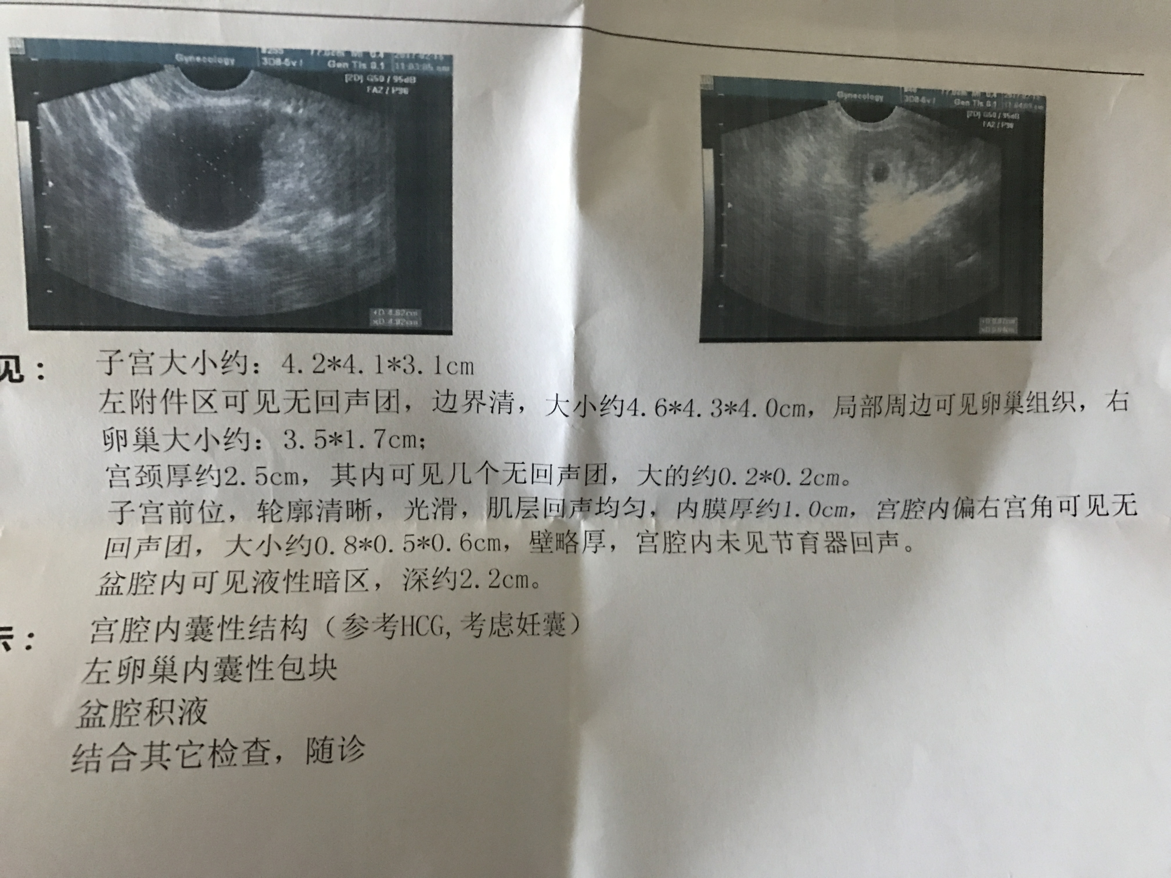 月經(jīng)晚來(lái)10多天，去醫(yī)院檢查，不能確定是否懷孕