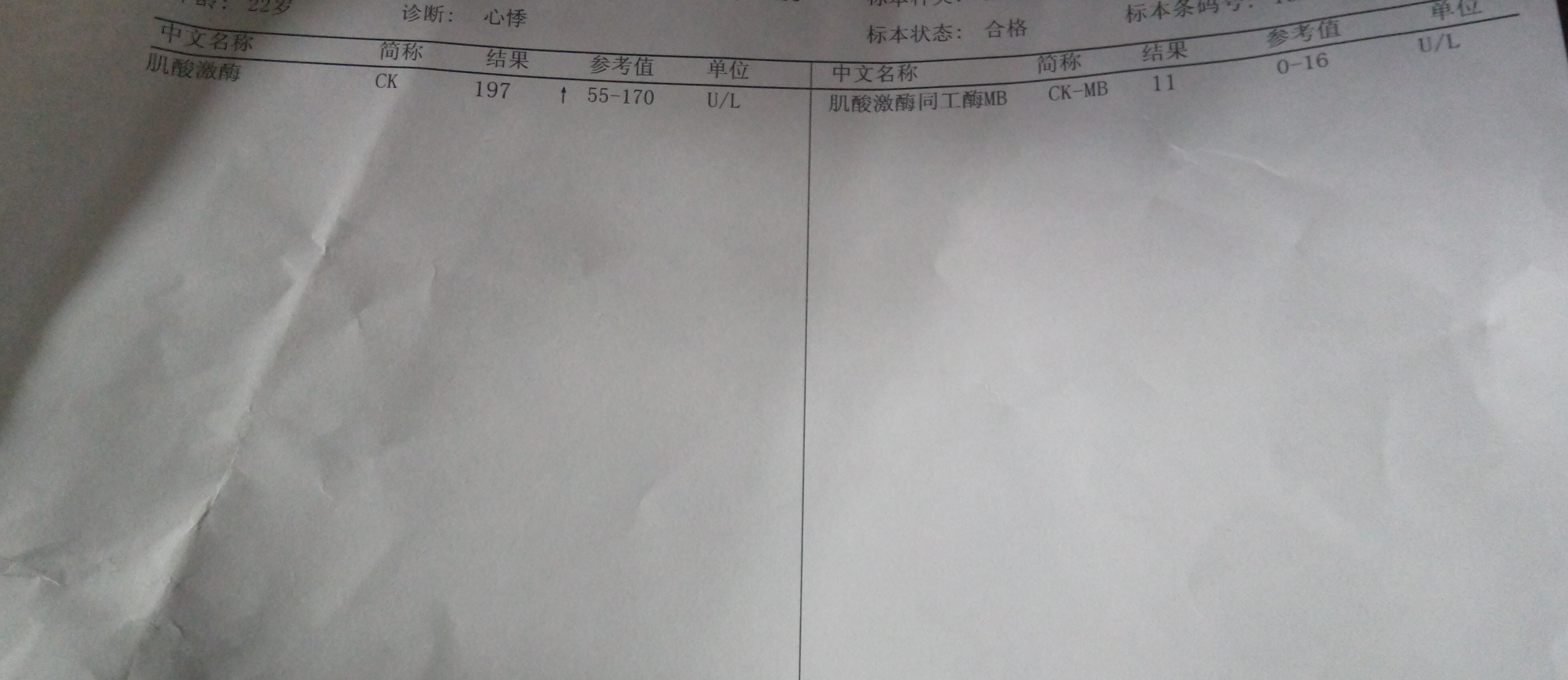 昨天心電圖查到左心室高電壓。心肌酸酶查到197U/L。而報告