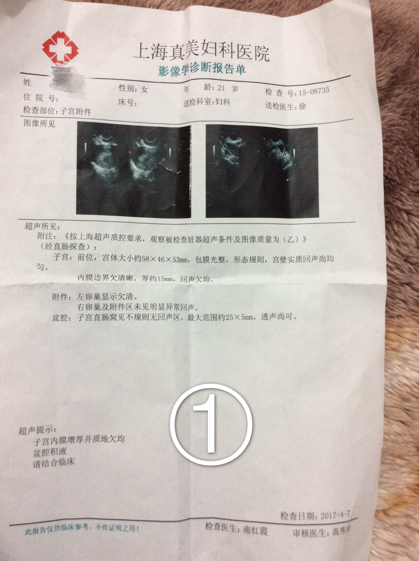 你好我是3.12號(hào)來月經(jīng)3.16號(hào)沒四月七號(hào)查hcg574B