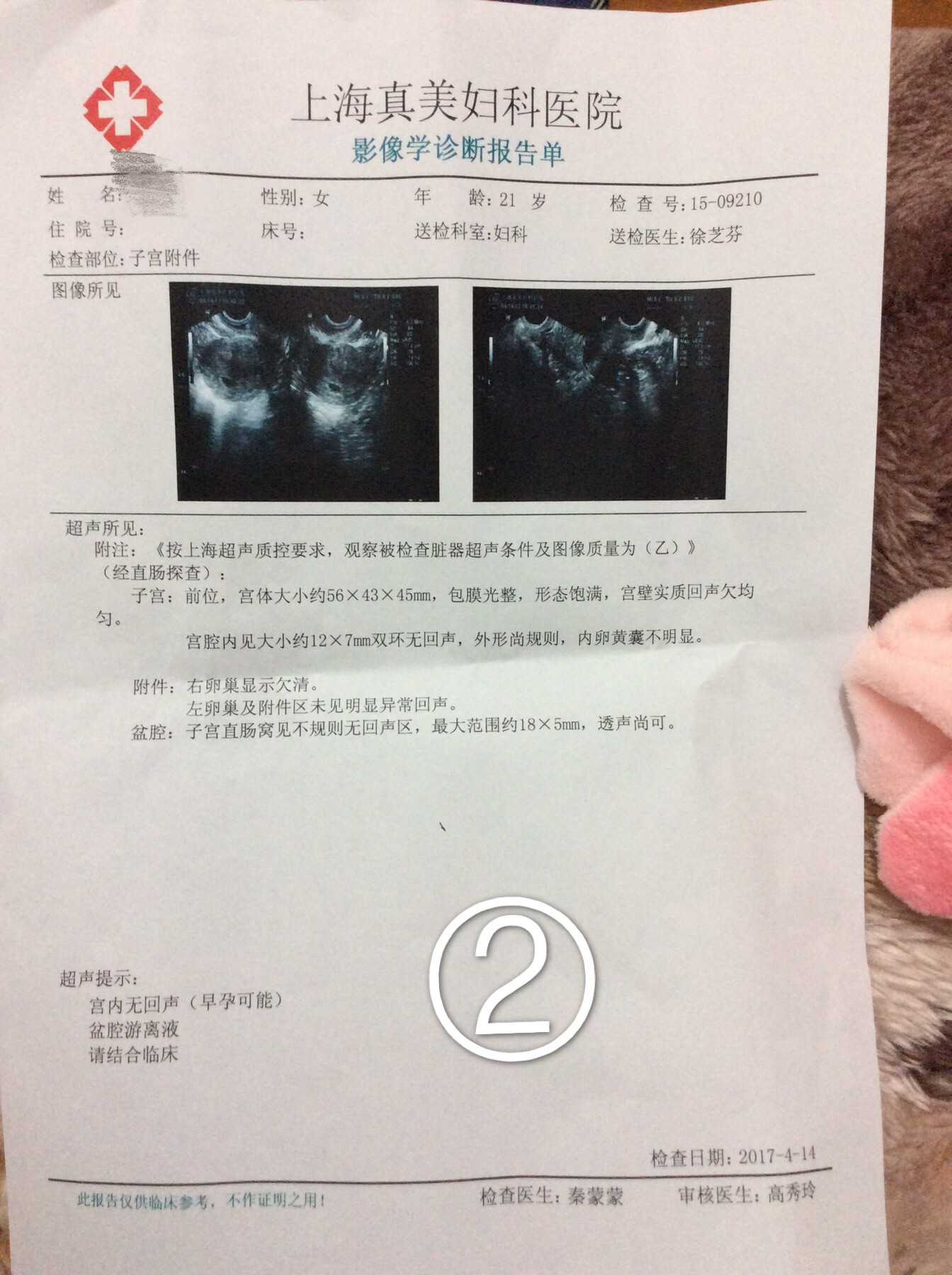 你好我是3.12號(hào)來月經(jīng)3.16號(hào)沒四月七號(hào)查hcg574B