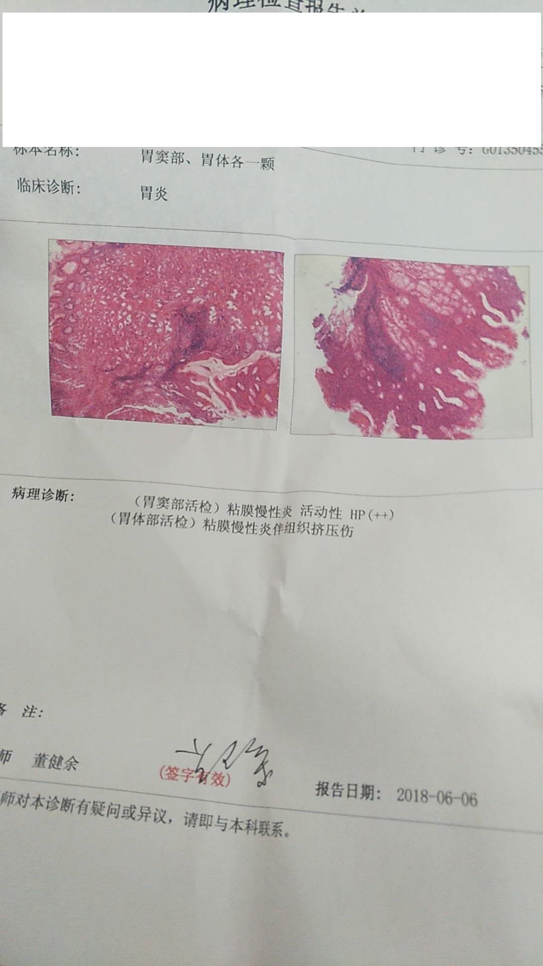 刚做胃镜检查比较严重有慢性胃炎伴糜烂血肿有十二指肠溃