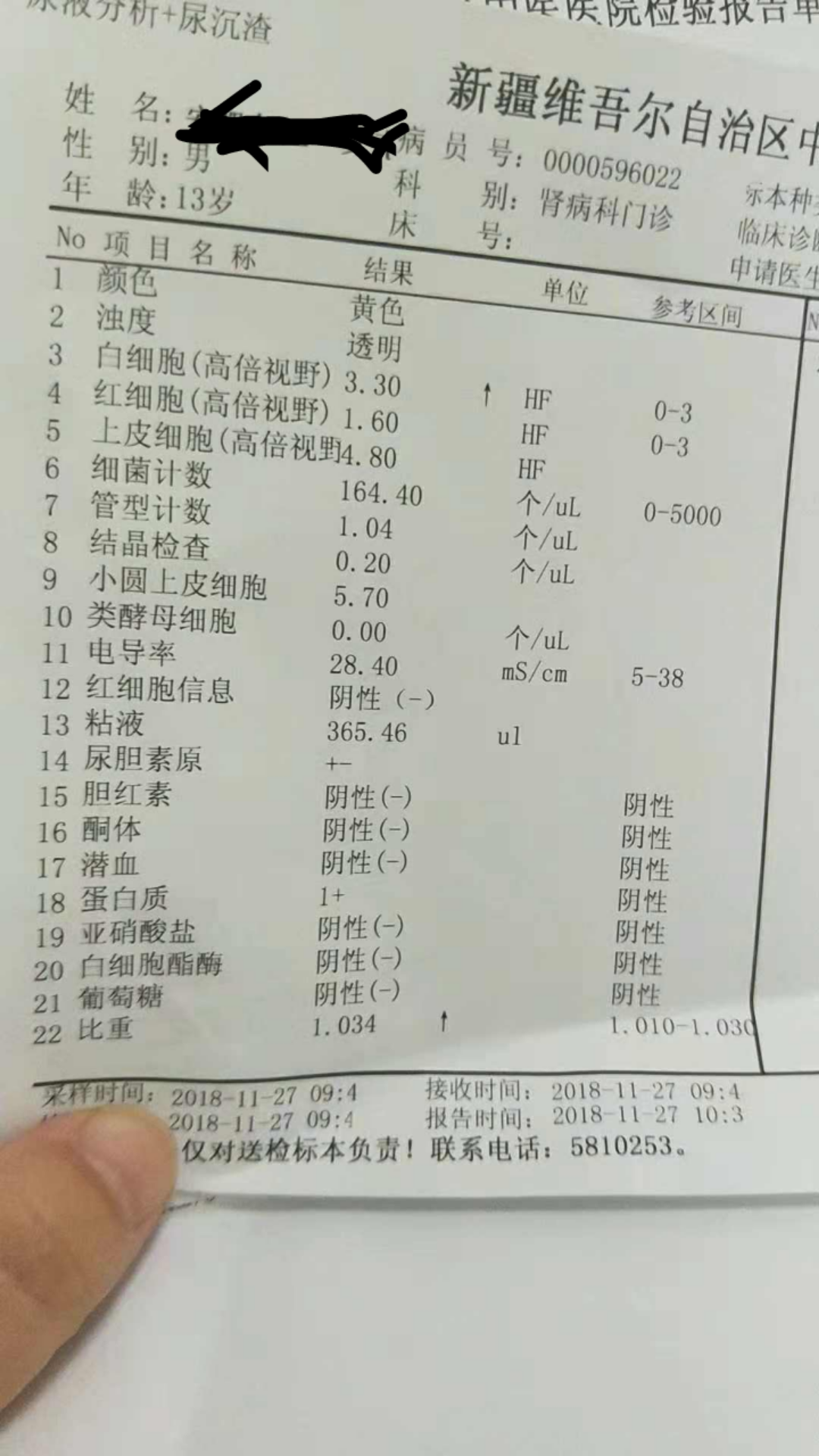 你好医生麻烦看一下检查结果尿蛋白124小时尿蛋白