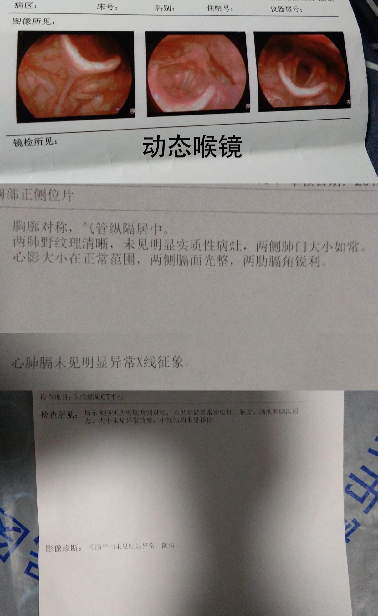 3个半月前胸口和背部疼痛喉咙不舒服呼吸困难疼痛半个月之后