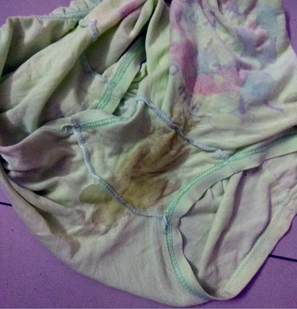 7岁小女孩,给她洗衣服发现内裤有黄的污迹,有点硬洗不干净像白带有很