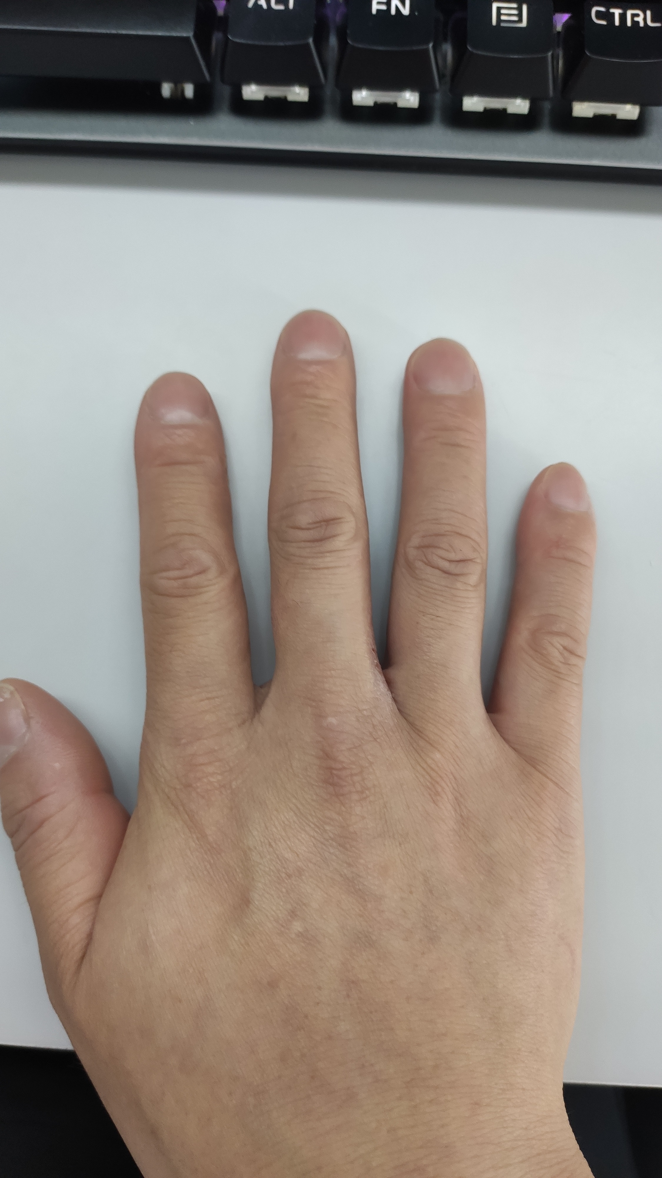 今天早上上班到公司同事说我的手指有点奇怪可能是杵状指说这种
