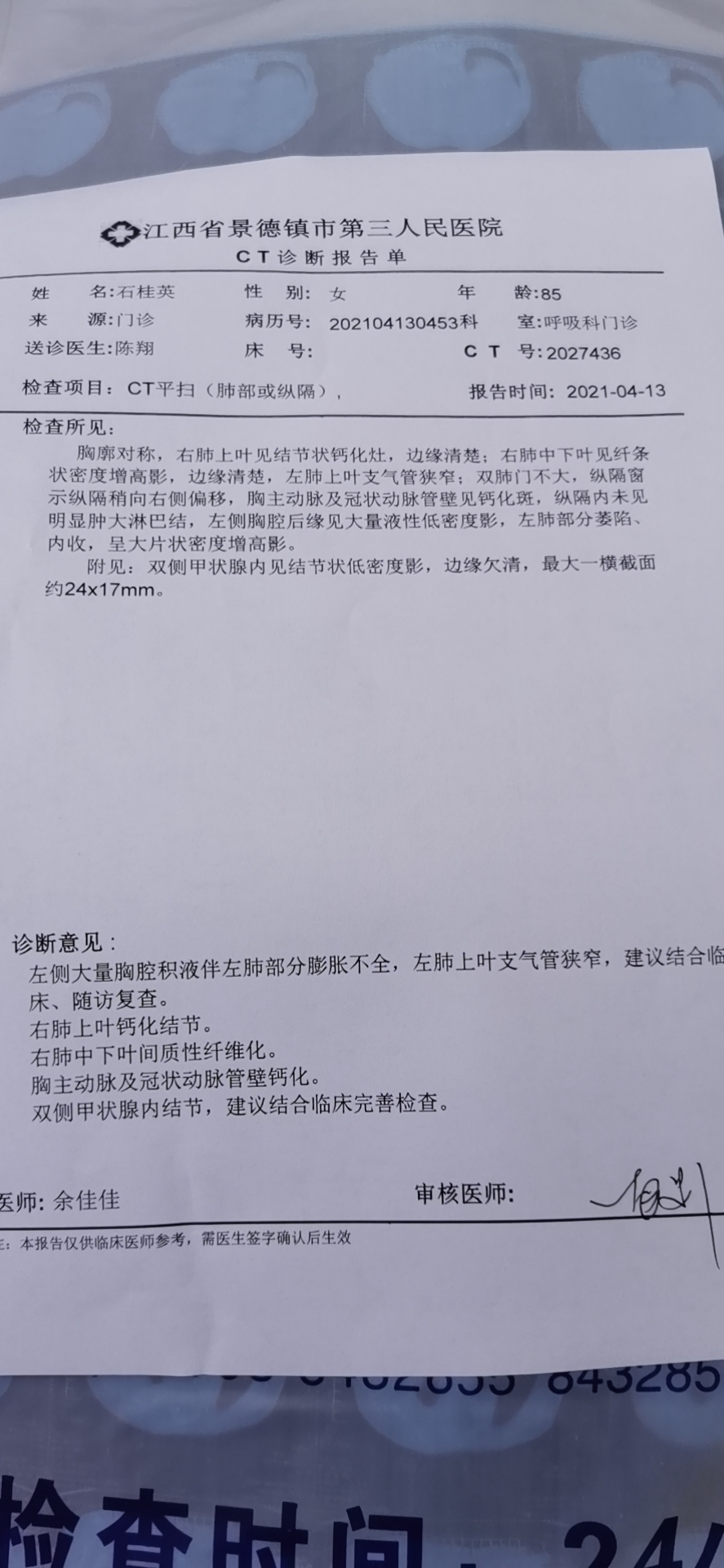 胸腔积液,左肺上叶支气管狭窄,双肺不大,有结节钙化灶