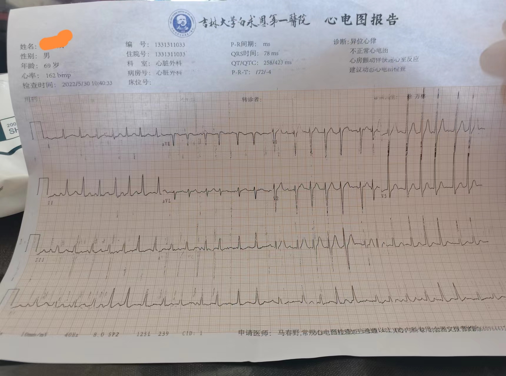 心臟，心動過宿睡不著覺