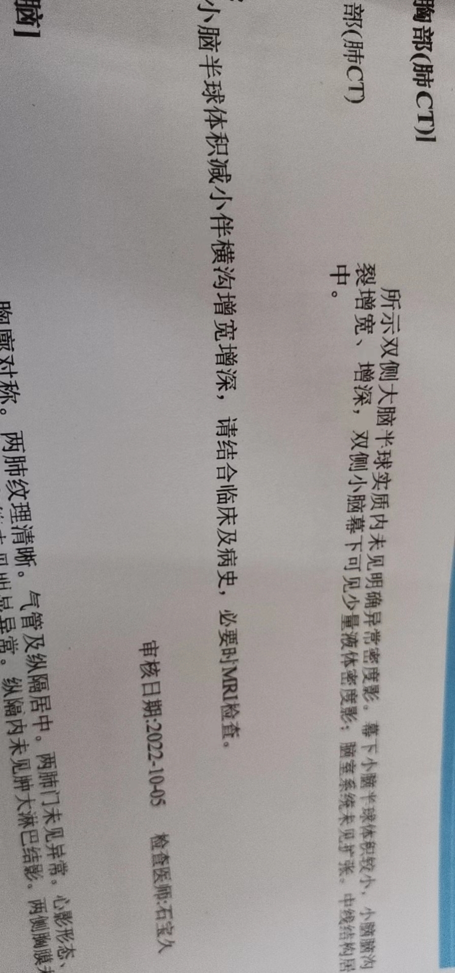 腦部CT看不懂，醫(yī)生可以幫忙看看怎么回事嗎