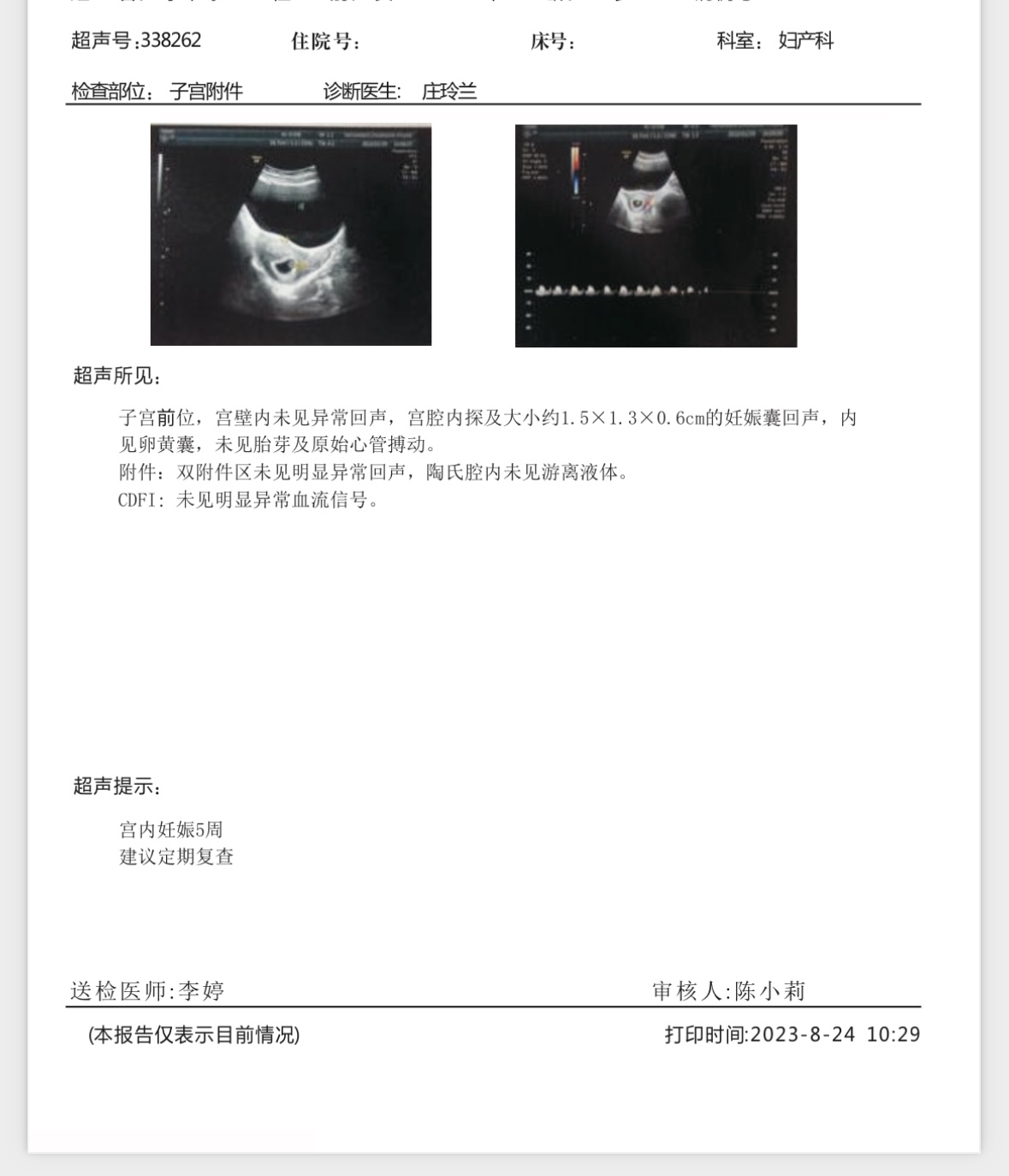 這個(gè)彩超圖中間五顏六色的是什么啊這個(gè)彩超是真的嗎