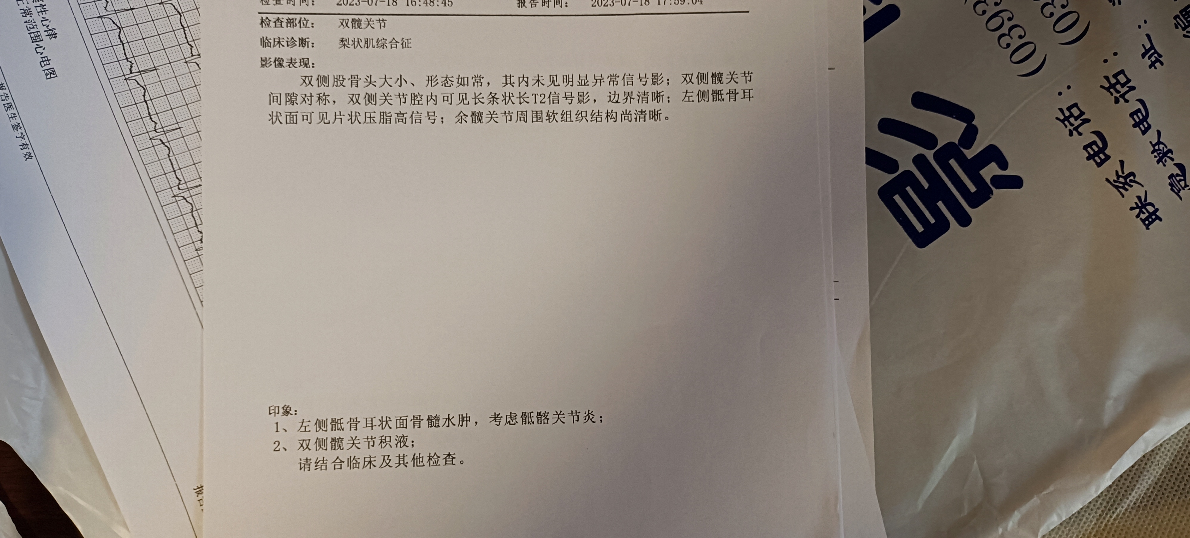 大夫您好，我是兩個(gè)月前以為左腿走路屁股疼痛，去醫(yī)院檢查說是骶