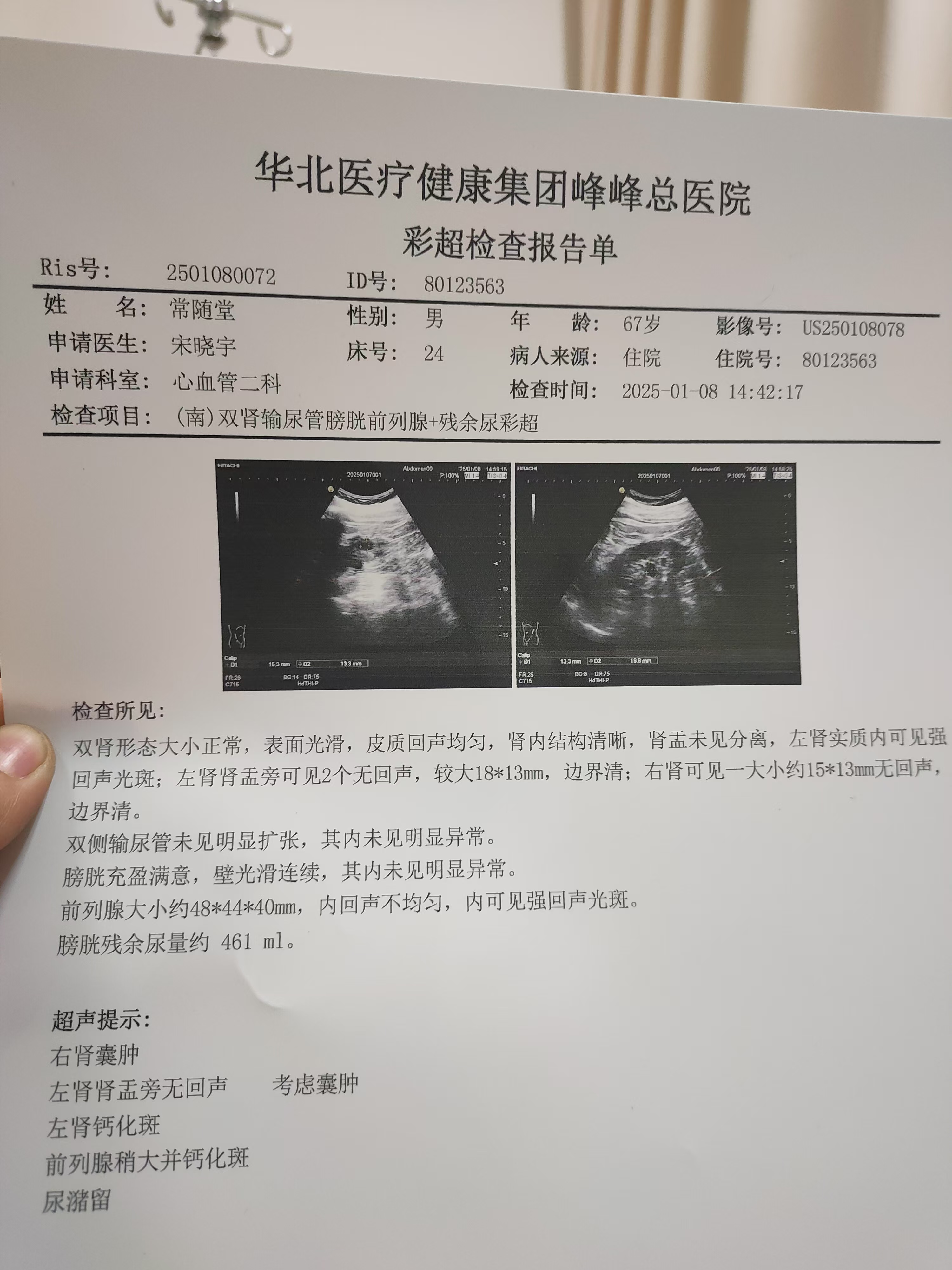 尿頻尿急前列腺增生