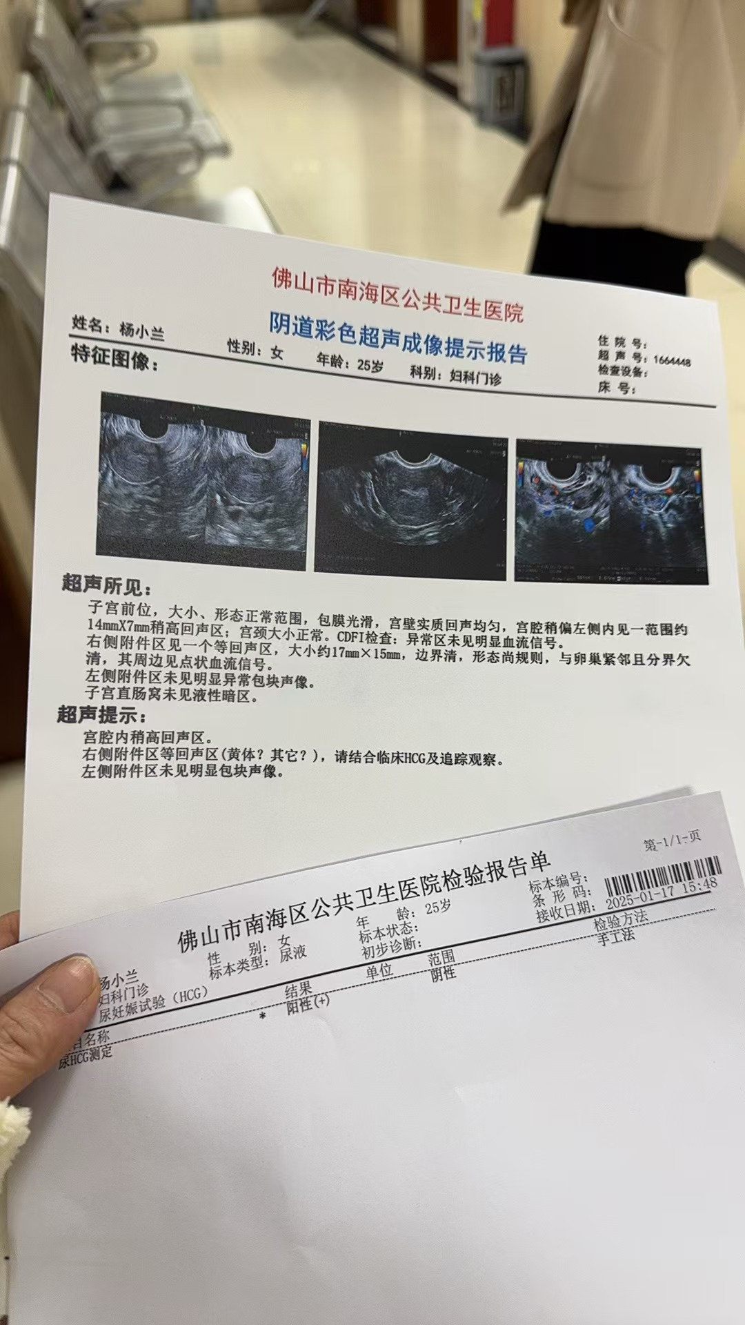 請幫忙查看一下這個是什么癥狀